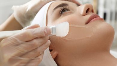 التقشير الكيميائي