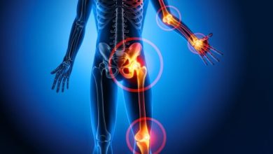 مرض الروماتيزم