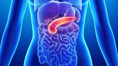 التهاب البنكرياس