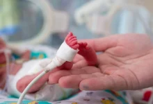 حليب الأطفال الخدج أو منخفضي الوزن عند الولادة