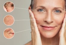 علاج تجاعيد الوجه طبيعيًا