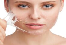 التقشير البارد