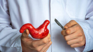 سلبيات عملية قص المعدة