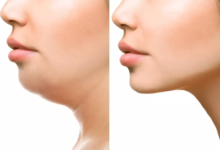 طريقة تنحيف الوجه