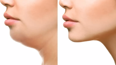 طريقة تنحيف الوجه