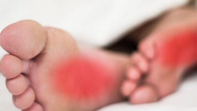 علاج حرارة القدمين الدكتور عبد الباسط