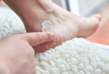 علاج تشققات القدمين في يوم واحد فقط مجرب وفعال