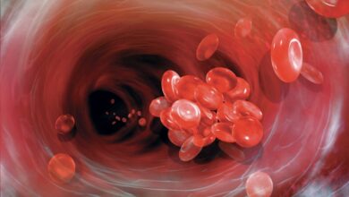 هل حموضة الدم تسبب الوفاة