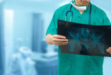 عنوان عيادة دكتور احمد عبد العزيز للعظام