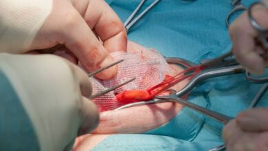 كيف اعرف ان عمليه الفتاق نجحت