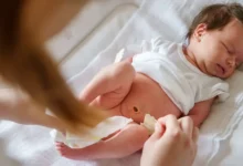 مراحل شفاء الختان بالصور