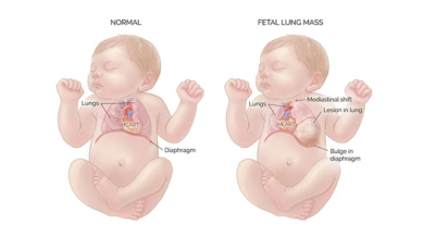 هل السونار يبين اكتمال الرئه