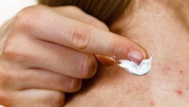 افضل مرهم لازالة اثار الحبوب والبقع الغامقة
