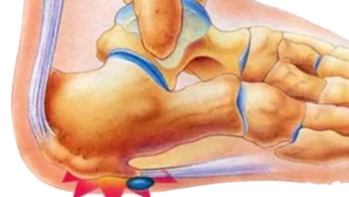 تجربتي مع الشوكة العظمية