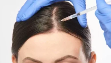 تجربتي مع حقن البلازما للشعر