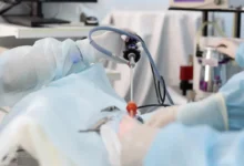 تجربتي مع منظار القولون