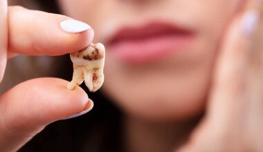 كسر الضرس في المنام