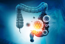 كيف تخرج جرثومة المعدة من الجسم