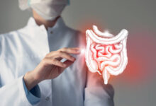 متى يزول خطر التسريب بعد التكميم