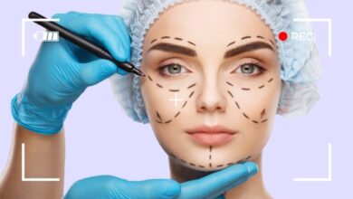 من هو دكتور تجميل الفنانات في مصر