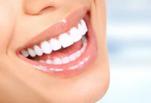 انواع واشكال ابتسامة هوليوود