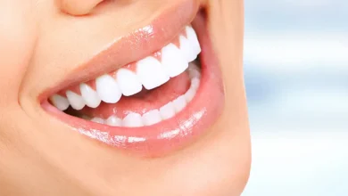 انواع واشكال ابتسامة هوليوود