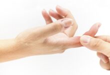 علاج الاصبع المدوحس بالعجينة