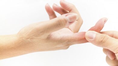 علاج الاصبع المدوحس بالعجينة