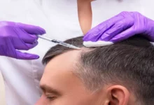 متى تظهر نتائج حقن البلازما للشعر