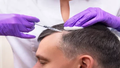 متى تظهر نتائج حقن البلازما للشعر