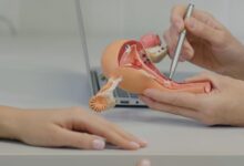 تكلفة عملية استئصال الرحم