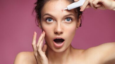 حمض الأزيليك 20 لتفتيح لون البشرة