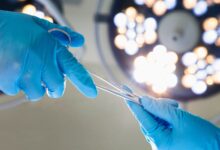 سعر عملية تفتيت حصى الكلى بالليزر