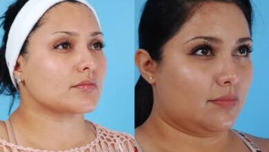 كيف اشيل اللغلوغ