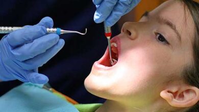 هل ينمو الضرس بعد خلعه للاطفال