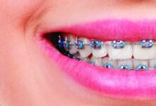 المثبت الدائم بعد التقويم