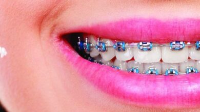 المثبت الدائم بعد التقويم