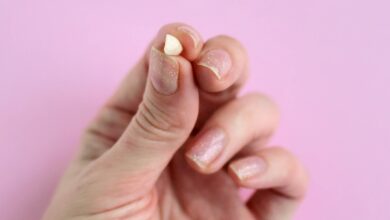 تفسير حلم سقوط الأسنان في اليد بدون ألم