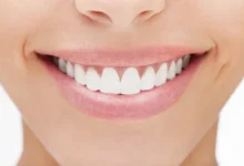 شكل الاسنان الطبيعي