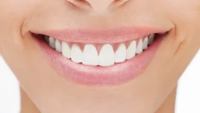 شكل الاسنان الطبيعي