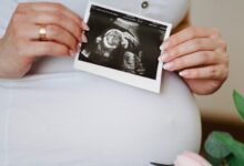 شكل كيس الجنين الذكر في الشهر الثاني