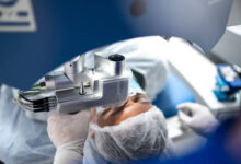 طريقة النوم بعد عملية الليزك