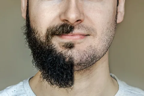 كيف اطلع شنب في أسبوع
