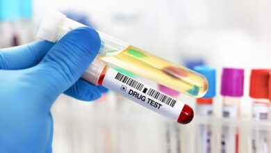 ما الشئ الذي يفسد تحليل المخدرات