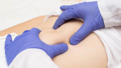 ما هو الفتق الاربي