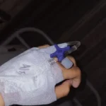 مريضة يد فيها مغذي في المستشفى