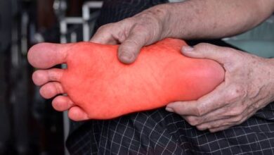 ميثايلتكنو للالتهابات العصبية